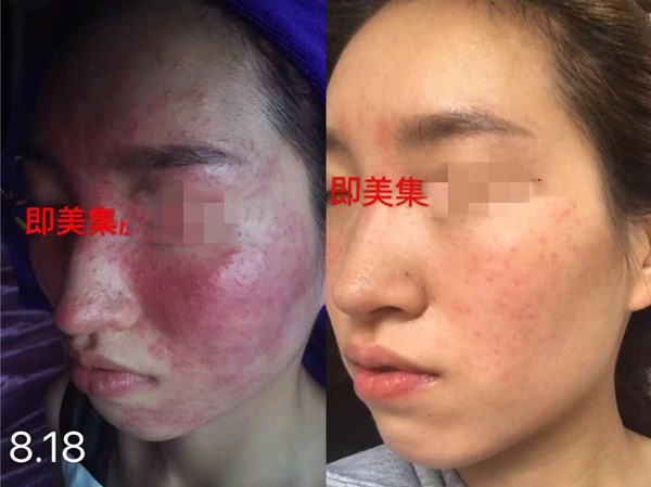 春季防敏，你需要補課的小訣竅！