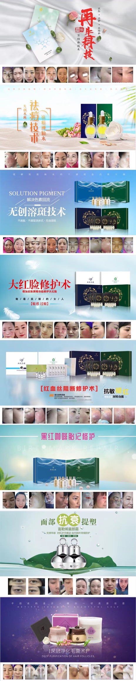 聚勢成美丨深耕行業21年，祛斑我們就是標準