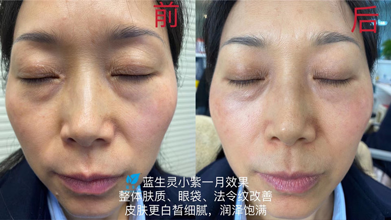 重磅新品丨一月換膚！她們是吃了美顏相機吧？？
