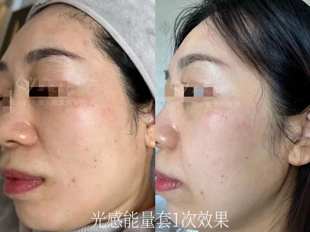 新品速遞丨拓客王者，升級回歸